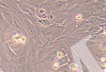 人成骨细胞永生化 Immortality of human osteoblasts