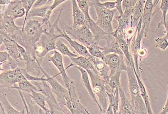 人支气管平滑肌细胞永生化 Immortalization of human bronchial smooth muscle cells