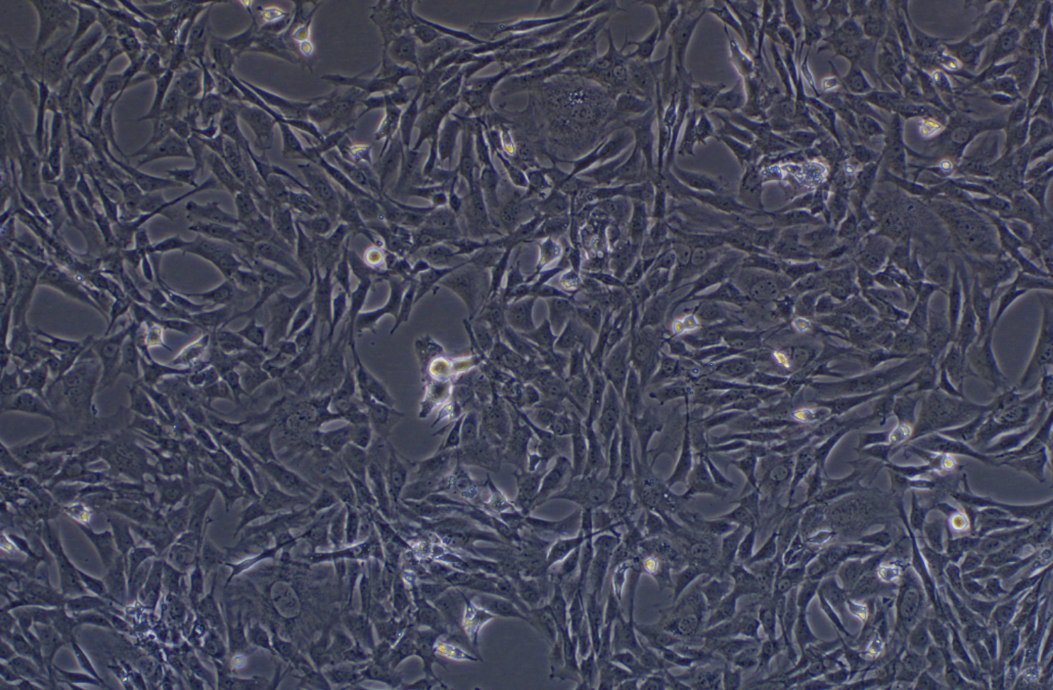人乳腺癌成纤维细胞永生化 Immortalization of human breast cancer fibroblasts