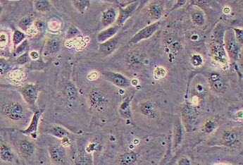 人脐静脉内皮细胞永生化HUVEC（免疫荧光鉴定） Immortalized HUVEC derived from human umbilical vein endothelial cells