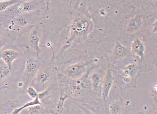 人淋巴管内皮细胞永生化 Immortalization of human lymphatic endothelial cells