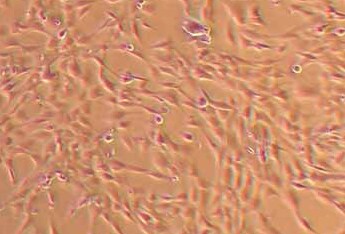 人软骨细胞永生化 Immortality of human chondrocytes