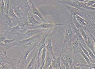 人睾丸支持细胞永生化 Immortality of human testicular supporting cells