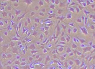 人主动脉瓣膜间质细胞永生化 Immortality of human aortic valve stromal cells