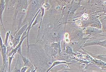 人肠息肉上皮细胞永生化 Immortalization of human intestinal polyp epithelial cells