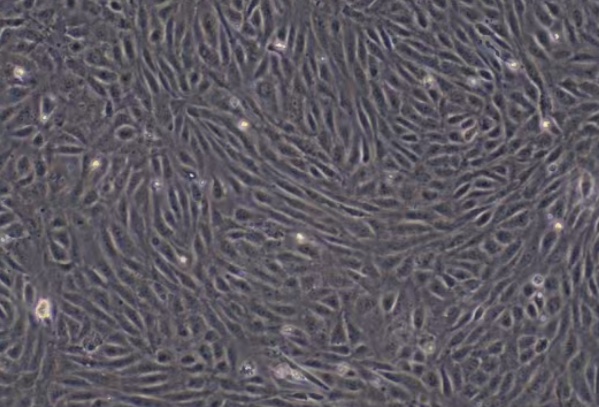 人主动脉内皮细胞永生化 Immortalization of human aortic endothelial cells