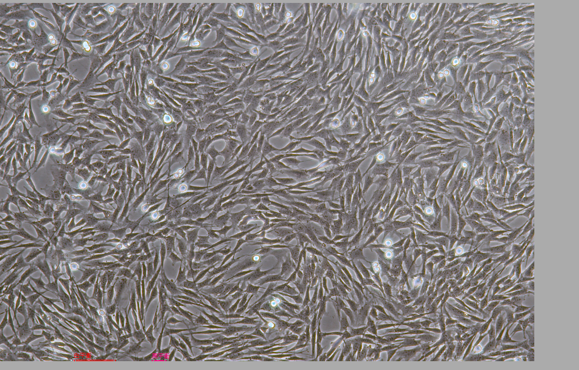 人风湿性关节滑膜成纤维细胞永生化 Immortality of human rheumatoid joint synovial fibroblasts
