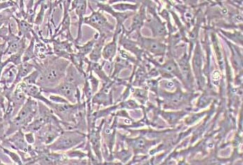 人胆囊上皮细胞永生化 Immortality of human gallbladder epithelial cells