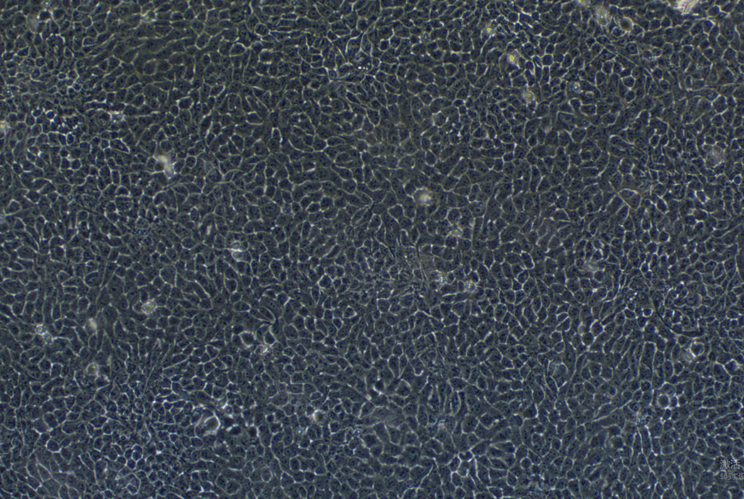 MCF10A (人正常乳腺上皮细胞) MCF10A (normal human breast epithelial cells)