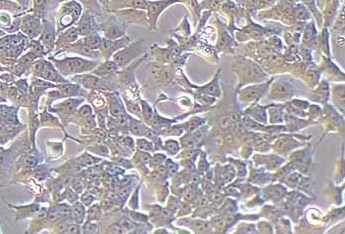 BIU-87 (人膀胱癌细胞系) (STR鉴定正确) BIU-87 (human bladder cancer cell) (STR identification correct)