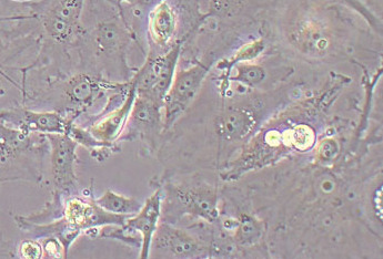 MDA-MB-157 (人乳腺癌细胞系) MDA-MB-157 (human breast cancer cell)