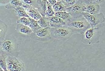 NCI-H292人肺癌细胞系(淋巴结转移) NCI-H292 human lung cancer cells (lymph node metastasis)