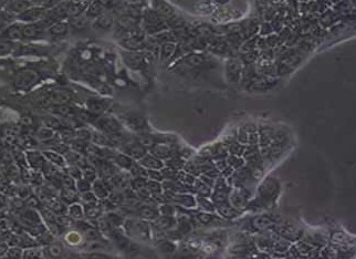 Capan-1人胰腺癌细胞系 Capan-1 human pancreatic cancer cell