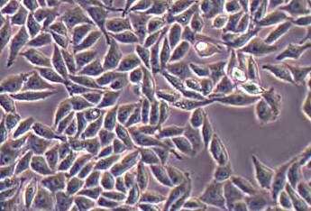 RKO (人结肠腺癌细胞系) (STR鉴定正确) RKO (human colon adenocarcinoma cells) (STR identification correct)