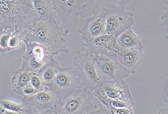SNU-182 (人肝癌细胞系) (STR鉴定正确) SNU-182 (human liver cancer cells) (STR identification correct)