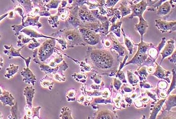 PATU8988T (人胰腺癌细胞系) (STR鉴定正确) PATU8988T (human pancreatic cancer cell) (STR identification correct)