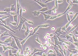 A-204人横纹肌肉瘤细胞系 A-204 human rhabdomyosarcoma cells