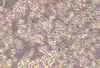 REH人急性非B非T淋巴细胞白血病细胞系 REH human acute non-B non-T lymphocytic leukemia cells