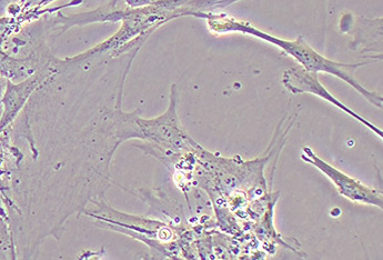 HFL-1人肺成纤维细胞系 HFL-1 human lung fibroblast cell line; HFL 1;Human fetal lung1;HFL