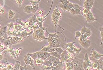 HEC-1-B人子宫膜腺癌细胞系 HEC-1-B human endometrial adenocarcinoma cells