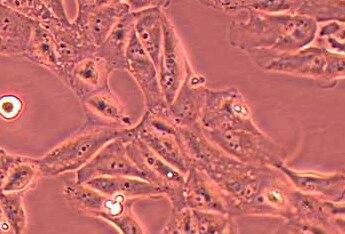 Caki-2人肾透明细胞癌细胞系 Caki-2 human renal clear cell carcinoma cells