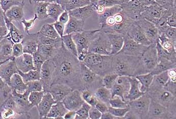 Caco-2 (人结直肠腺癌细胞系) (STR鉴定正确) Caco-2 (human colorectal adenocarcinoma cells)