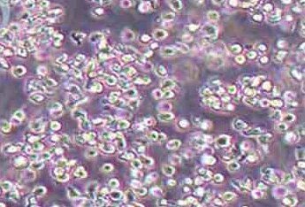 6T-CEM (人T细胞白血病细胞系) (STR鉴定正确) 6T-CEM (human T-cell leukemia cells)