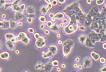NCI-H1944 (人肺癌细胞系) (STR鉴定正确) NCI-H1944 (human lung cancer cells) (STR identification correct)
