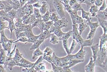 NCI-H157人非小细胞肺腺癌细胞系 NCI-H157 human non-small cell lung adenocarcinoma cells