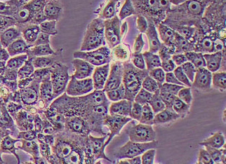 MCF-7人乳腺癌细胞系 MCF-7 human breast cancer cells