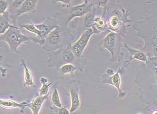 KYSE-410 (人食管鳞癌细胞系) (STR鉴定正确) KYSE-410 (human esophageal squamous cell carcinoma cells)
