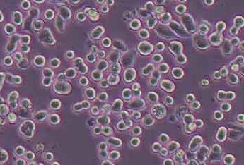 KATO III [KATO 3] (人胃癌细胞系) (STR鉴定正确)