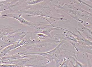 HSF人皮肤成纤维细胞系 HSF human skin fibroblasts