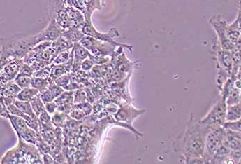 HCC827人非小细胞肺癌细胞系 HCC827 human non-small cell lung cancer cells