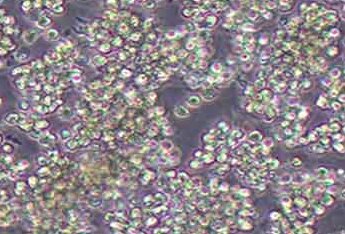 MOLM-13人急性髓细胞样白血病细胞系 MOLM-13 acute myeloid leukemia cells