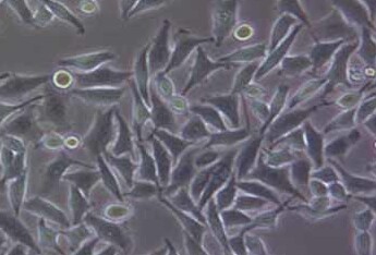 SMMC-7721人肝癌细胞系 SMMC-7721 human liver cancer cells