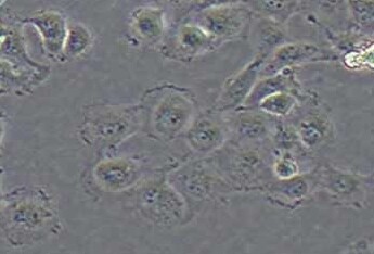 T24人膀胱癌细胞系 T24 human bladder cancer cells