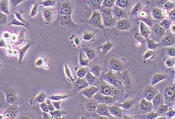 CAL-27人舌鳞癌细胞系 CAL-27 human tongue squamous cell carcinoma cells