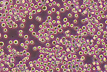 COLO205人结肠癌细胞系 COLO205 human colon cancer cells