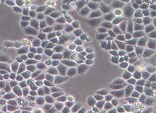 C33A人宫颈癌细胞系 C33A human cervical cancer cells