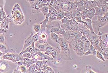 OV-90 (人卵巢癌细胞系) OV-90 (human ovarian cancer cells)