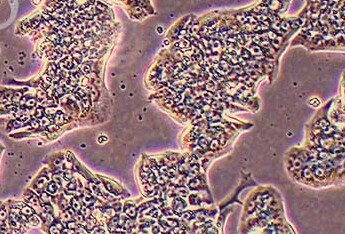 SW837 (人结直肠腺癌上皮细胞系) SW837 (human colorectal adenocarcinoma epithelial cells)
