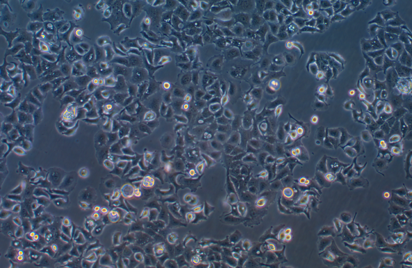 SW 780 [SW-780, SW780] (人膀胱移行细胞系癌) (STR鉴定正确)