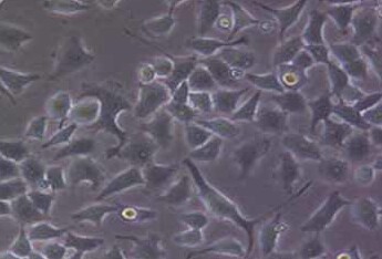 BGC-823人胃腺癌细胞系(低分化） BGC-823 human gastric adenocarcinoma cells (poorly differentiated)