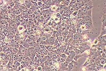 A-673 (人横纹肌肉瘤细胞系) (STR鉴定正确) A-673 (human rhabdomyosarcoma cells)