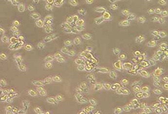 CA46 (人Burkitt's淋巴瘤细胞系) (STR鉴定正确) CA46 (human Burkitt's lymphoma cells)