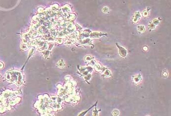 SK-NEP-1 (人肾母细胞瘤细胞系) (STR鉴定正确) SK-NEP-1 Wilms'tumor cell