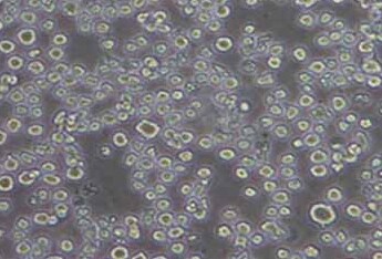U266 (人多发性骨髓瘤细胞系) (STR鉴定正确) U266 (human multiple myeloma cells) (STR identification correct)
