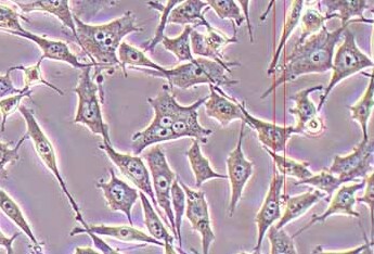 PC-3人前列腺癌细胞系 PC-3 human prostate cancer cells