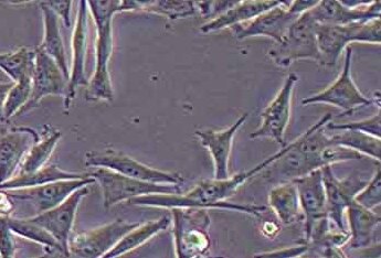 A2058 (人皮肤癌细胞系) (STR鉴定正确) A2058 (human skin cancer cells) (STR identification correct)